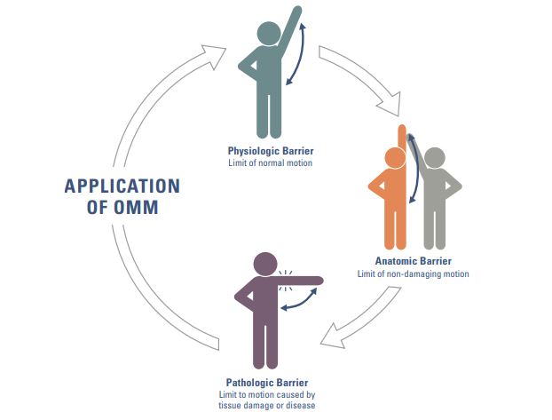 OMM can be applied to ease physiologic, anatomic or pathologic motion barriers.